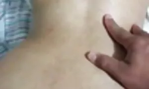ku-anal prolapse umf ...