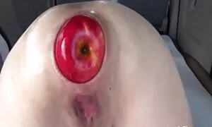 i-anal fisting eyeqi ...